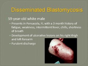 Disseminated Blastomycosis 59 yearold white male Presents in