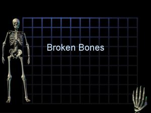 Broken Bones How Do Bones Break Bones are