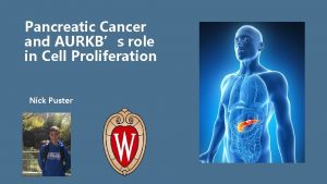 Pancreatic Cancer and AURKBs role in Cell Proliferation