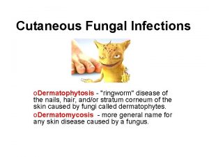 Cutaneous Fungal Infections o Dermatophytosis ringworm disease of