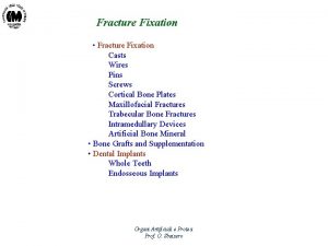 Fracture Fixation Fracture Fixation Casts Wires Pins Screws