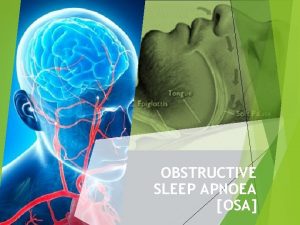 OBSTRUCTIVE SLEEP APNOEA OSA OSA a common problem