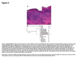 Figure 2 Histopathologic analysis of yawslike lesions in