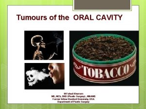 Tumours of the ORAL CAVITY M Fahud Khurram