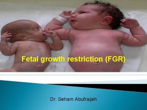 Fetal growth restriction FGR Dr Seham Abufraijeh Normal