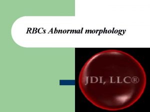 RBCs Abnormal morphology Mohammed laqqan Blood Cells Mohammed