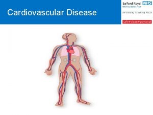 Cardiovascular Disease jjjjjjjjjjj Cardiovascular Disease Progressive Disease Includes