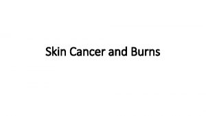 Skin Cancer and Burns Skin Cancer One in