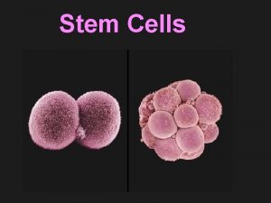 Stem Cells Importance of Stem Cell Research Stem