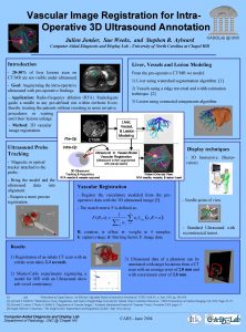 Vascular Image Registration for Intra Operative 3 D