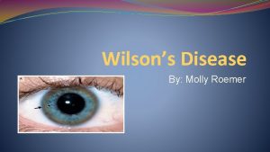 Wilsons Disease By Molly Roemer Meet Tommy A