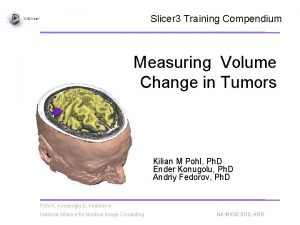 Slicer 3 Training Compendium Measuring Volume Change in