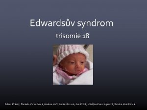 Edwardsv syndrom trisomie 18 Adam Krsn Daniela Kohoutkov