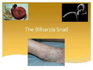 The Bilharzia Snail WHAT IS IT The snail