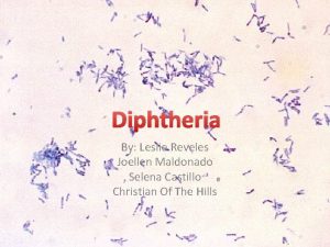 Diphtheria By Leslie Reveles Joellen Maldonado Selena Castillo