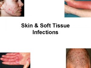 Skin Soft Tissue Infections Anatomy of the Skin