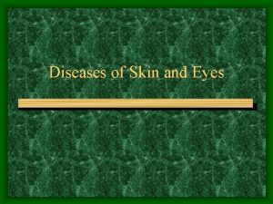 Diseases of Skin and Eyes Antibiotics BroadNarrow spectrum