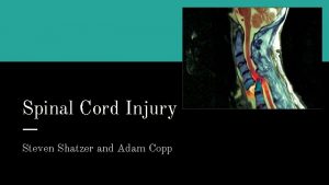Spinal Cord Injury Steven Shatzer and Adam Copp