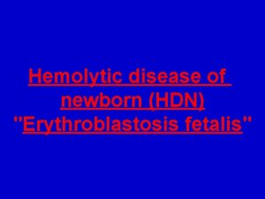 Hemolytic disease of newborn HDN Erythroblastosis fetalis HDN