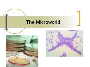 The Microworld Foodborne Diseases Definitions n n Foodborne