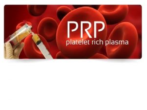 What Is Plateletrich Plasma PRP Is blood plasma