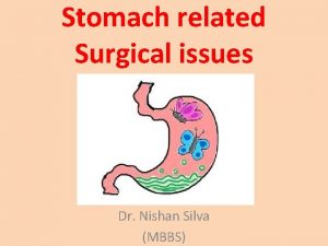 Stomach related Surgical issues Dr Nishan Silva MBBS