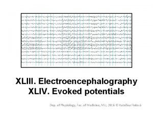 XLIII Electroencephalography XLIV Evoked potentials Dep of Physiology