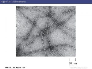 Figure 12 1 Actin filaments Figure 12 2