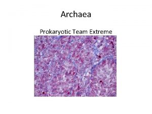 Archaea Prokaryotic Team Extreme Introduction Archaea are prokaryotic