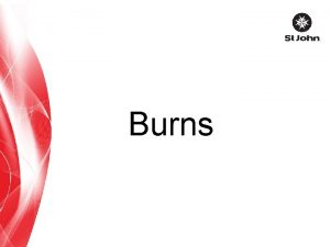 Burns Burns Burn injuries are extremely painful Risk