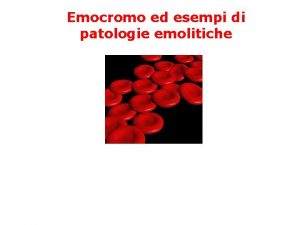 Emocromo ed esempi di patologie emolitiche Globuli rossi