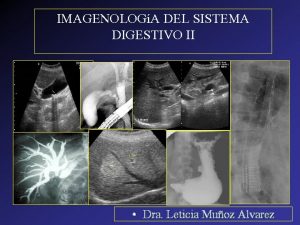 IMAGENOLOGA DEL SISTEMA DIGESTIVO II Dra Leticia Muoz