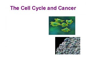 The Cell Cycle and Cancer Checkpoints in the