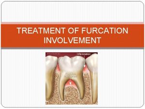 TREATMENT OF FURCATION INVOLVEMENT Furcation Furcate to divide