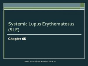 Systemic Lupus Erythematosus SLE Chapter 65 Copyright 2014