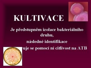 KULTIVACE Je pedstupnm izolace bakterilnho druhu nsledn identifikace