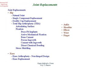Joint Replacements Hip Natural Joint Single Component Replacement