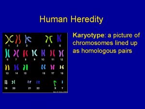 Human Heredity Karyotype Karyotype a picture of chromosomes