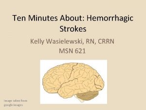 Ten Minutes About Hemorrhagic Strokes Kelly Wasielewski RN