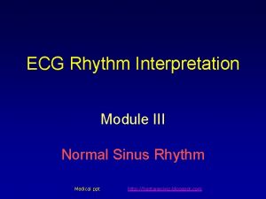 ECG Rhythm Interpretation Module III Normal Sinus Rhythm