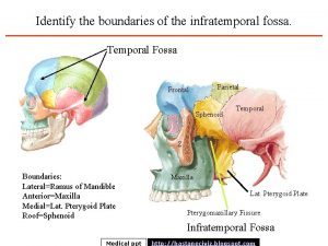 Identify the boundaries of the infratemporal fossa Temporal