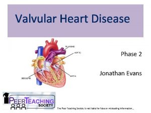 Valvular Heart Disease Phase 2 Jonathan Evans The