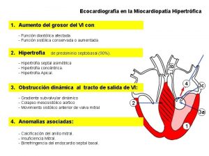 Ecocardiografa en la Miocardiopata Hipertrfica 1 Aumento del