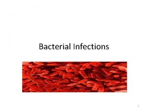 Bacterial Infections 1 Classification of Antiinfective Drugs Antiinfective