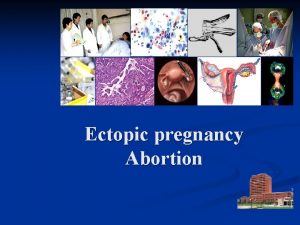 Ectopic pregnancy Abortion Ectopic pregnancy Definition Implantation outside