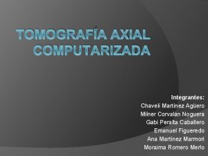 TOMOGRAFA AXIAL COMPUTARIZADA Integrantes Chaveli Martnez Agero Milner