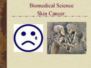 Biomedical Science Skin Cancer Skin Cancer Most common