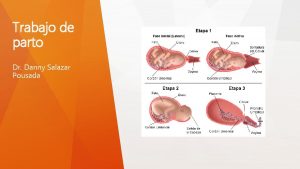 Trabajo de parto Dr Danny Salazar Pousada Generalidades