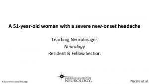 A 51 yearold woman with a severe newonset