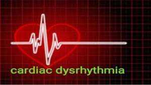 DEFINITION Heart rhythm problems heart arrhythmias occur when